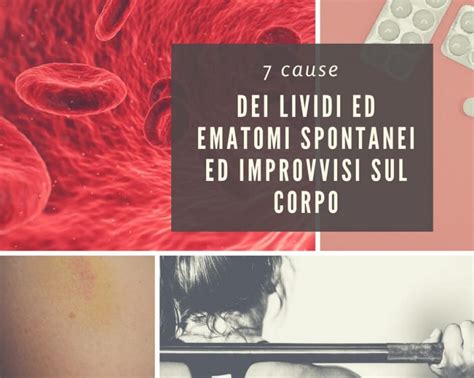 lividi e ematomi sul corpo.